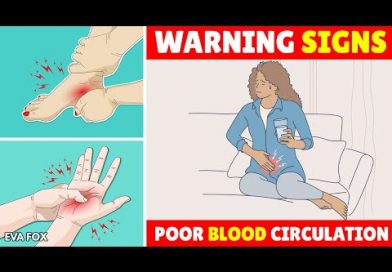 12 Warning Signs of Poor Blood Circulation
